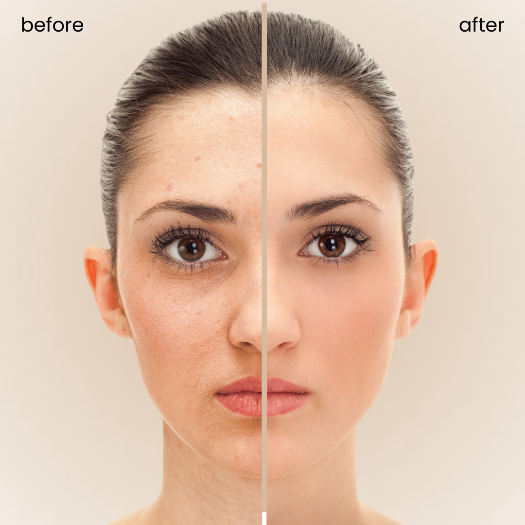 Glow & Go Beauty Balm